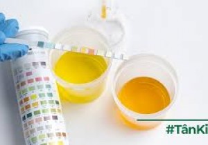 Yêu cầu báo giá các mặt hàng Vật tư, hóa chất xét nghiệm nước tiểu tại Bệnh viện Đa khoa khu vực miền núi phía Bắc Quảng Nam